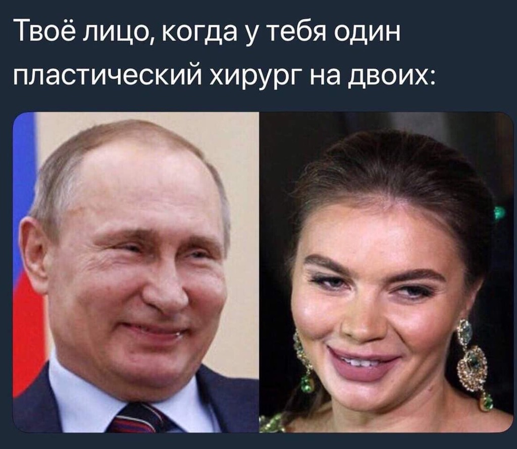 Алина Кабаева до и после пластики